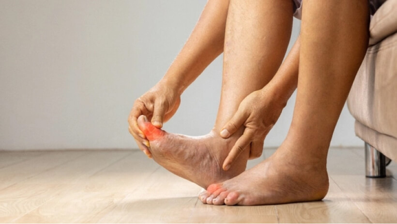 Nature Eliminate Uric Acid