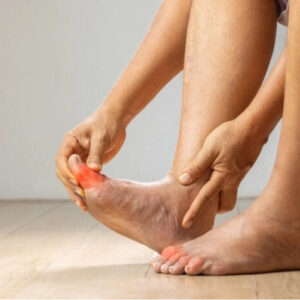 Nature Eliminate Uric Acid