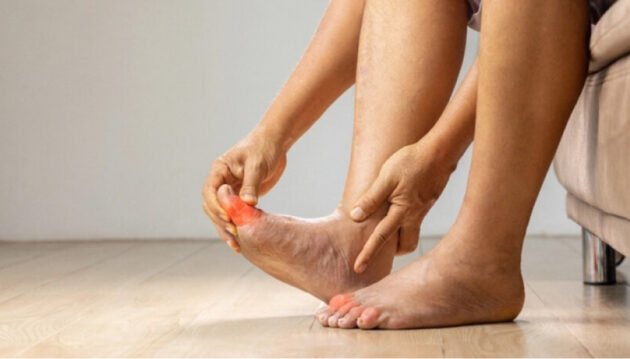 Nature Eliminate Uric Acid
